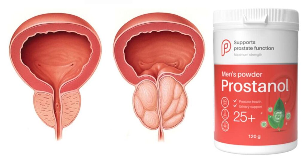 Prostanol Prezzo